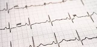 Eletrocardiograma